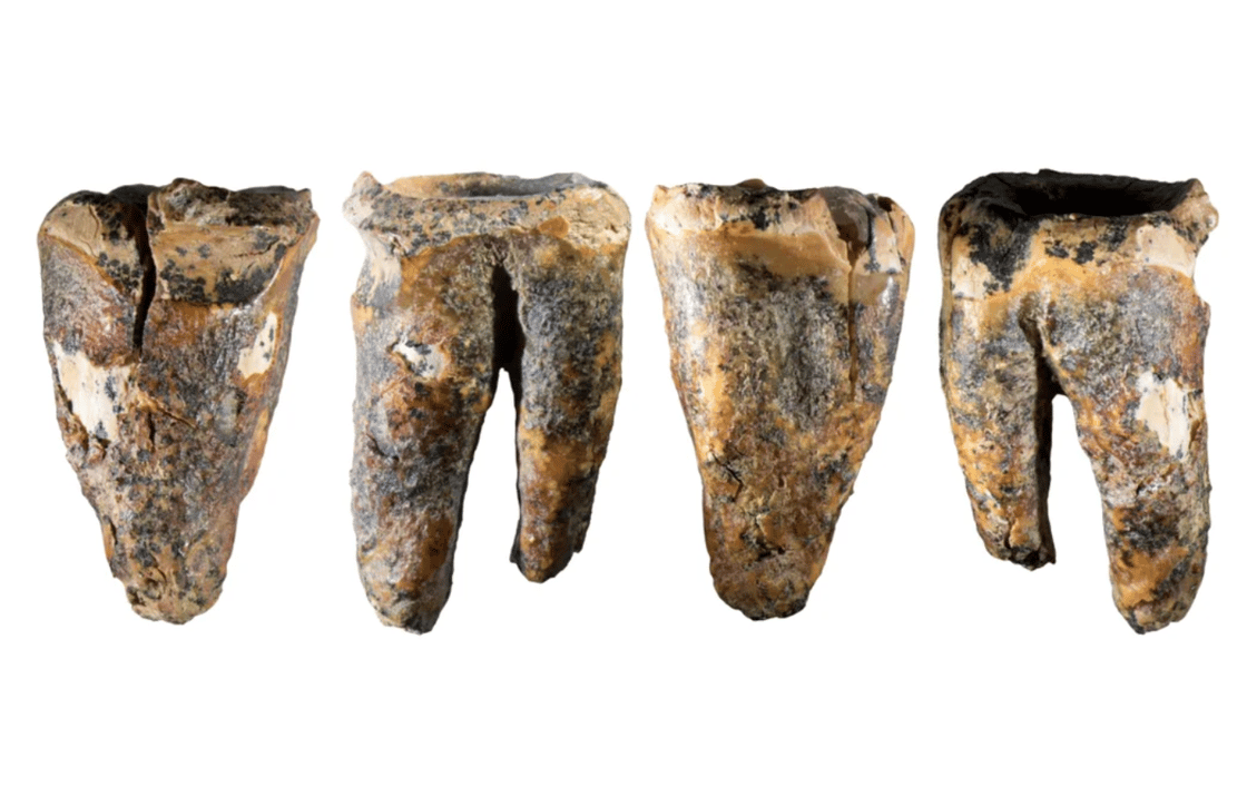 teeth-1